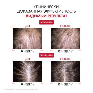 VICHY DERCOS Technique Aminexil Clinical R.E.G.E.N BOOSTER Сыворотка для укрепления и роста волос, 90 мл